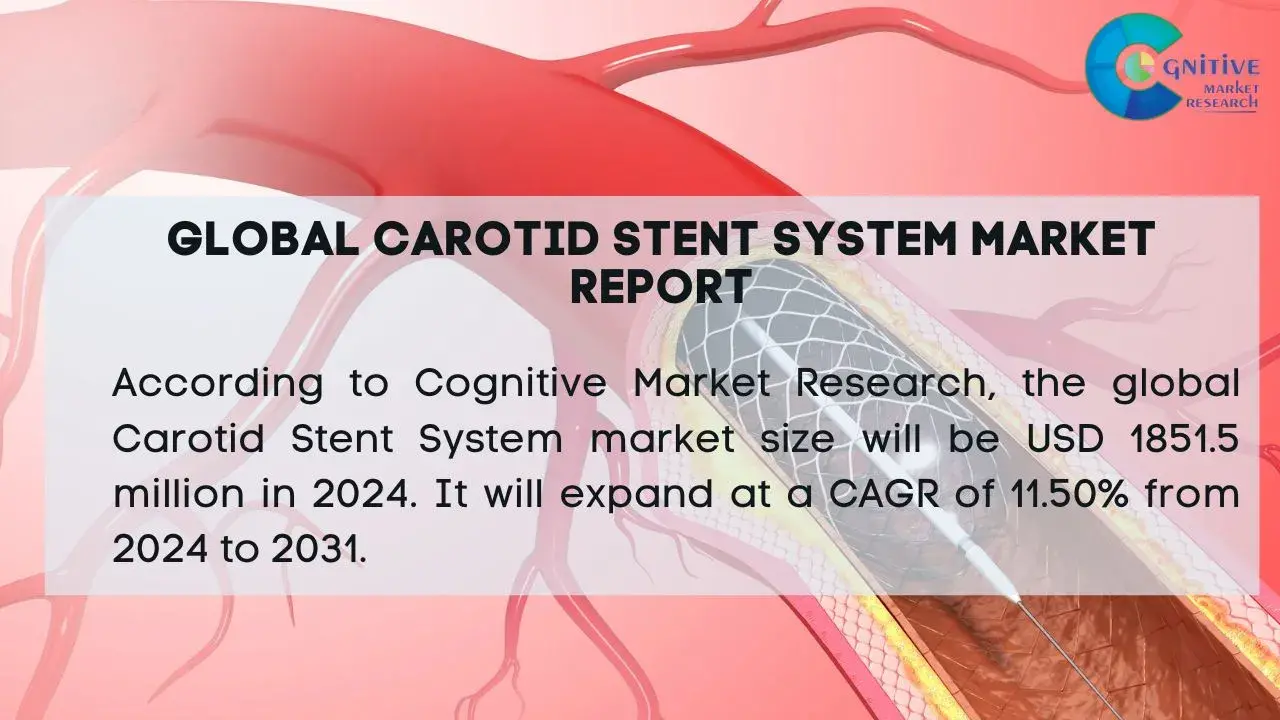Carotid Stent System Market Report