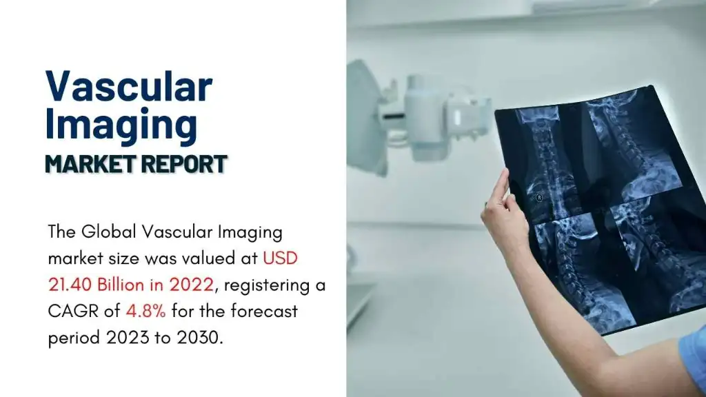 Vascular Imaging Market Report