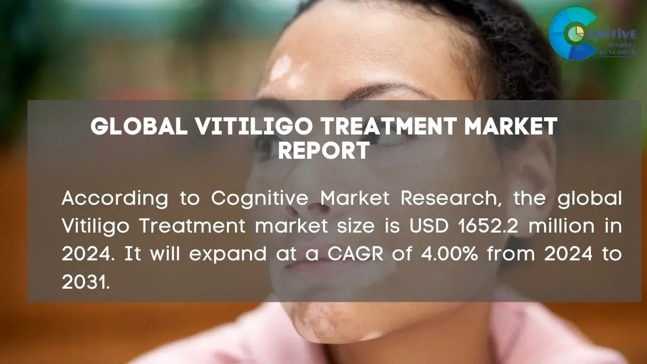 Vitiligo Treatment Market Report