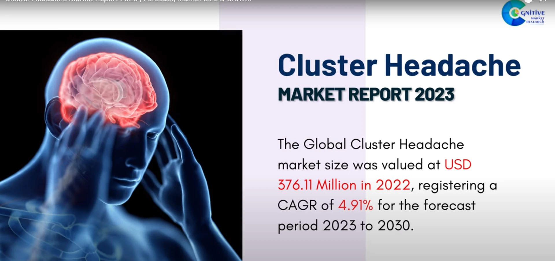 Cluster Headache Market Report